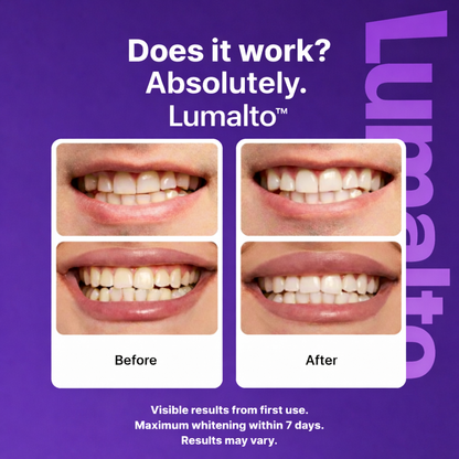 Lumalto™ Color-Correct Whitening Strips